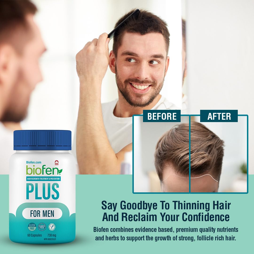 Biotin for Hair Growth Supplement with Vitamins B2, B3, B6, Saw Palmetto, Fenugreek Seed, Flax Lignan, & Biotin for Hair Regrowth for Men, Hair-loss Treatment and Prevention, Made in Canada